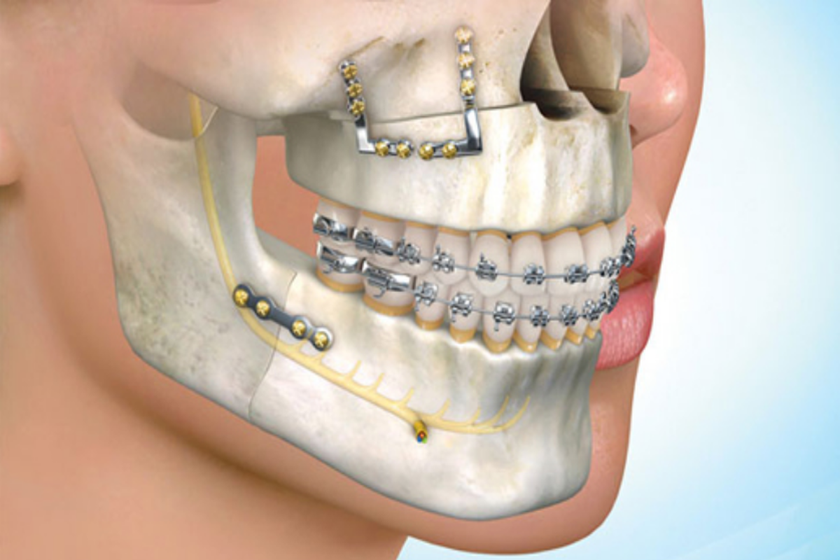 .//wp-content/uploads/2023/10/Maxillofacial-Surgery1200x800.png